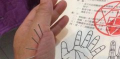 北京哪些大学有康复治疗专业课程