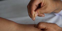 北京针灸推拿专业学制是多久？是几年